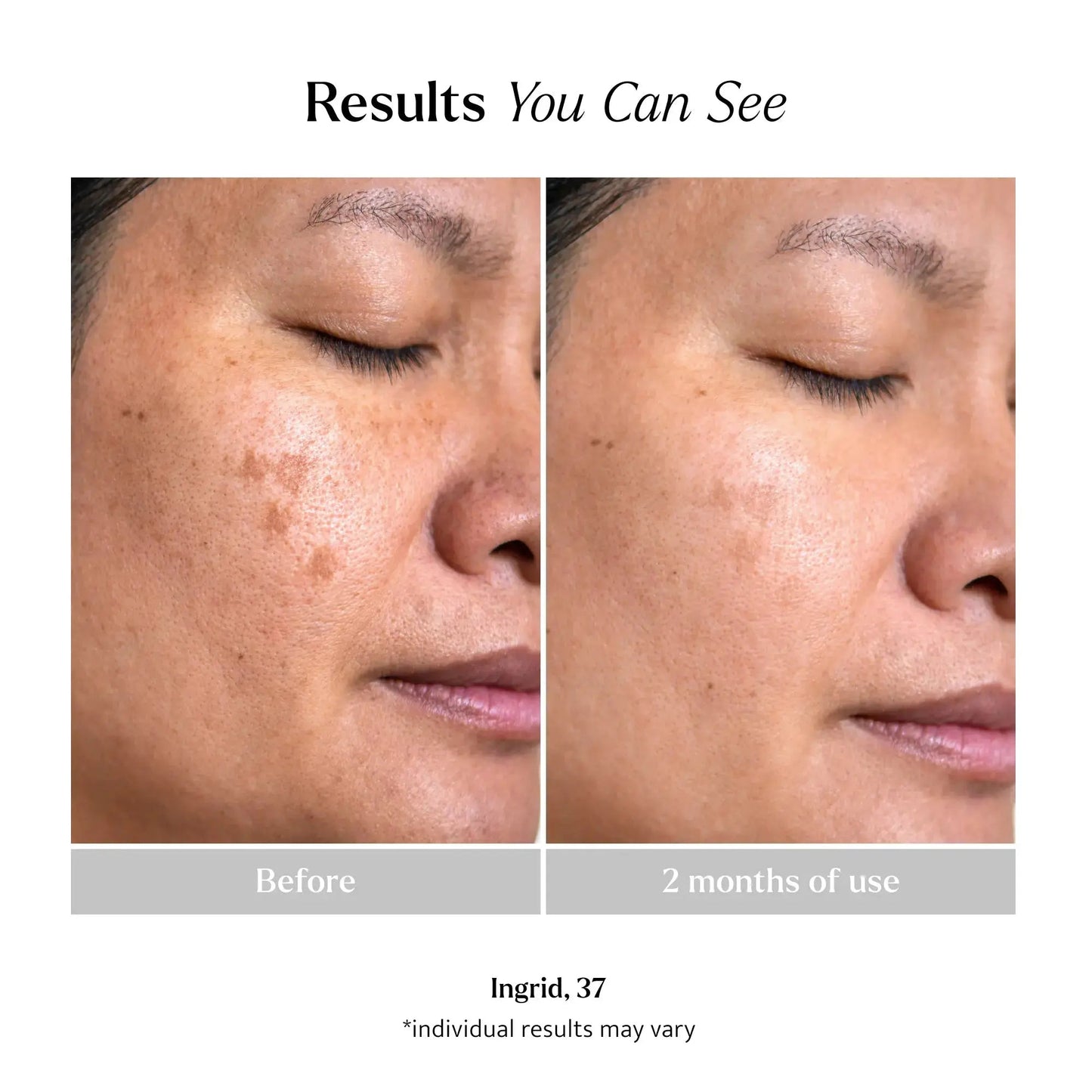 Vitamin C Serum product photo 5