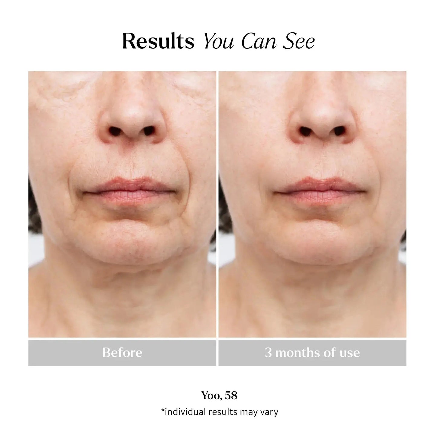 Ageless Serum product photo 5
