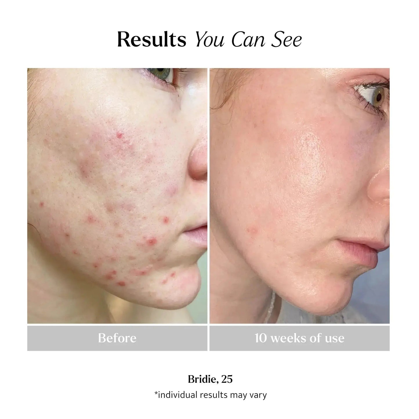 Brightening Sheet Mask product photo 5
