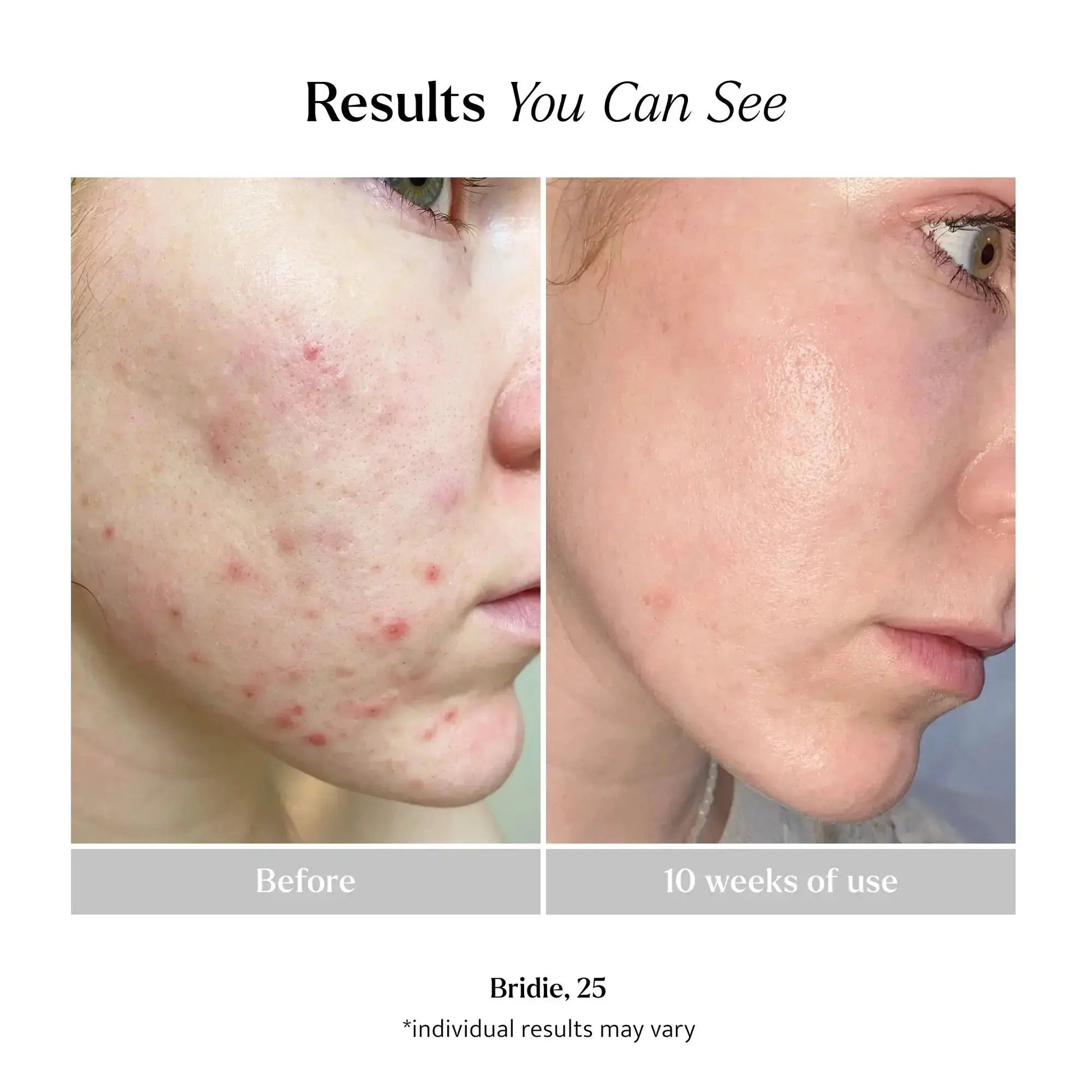 Brightening Sheet Mask product photo 5